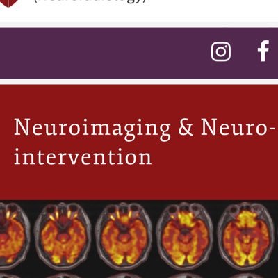 This is the official twitter account for Neuroimaging and Neurointervention (Neuroradiology) at Stanford University