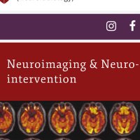 stanfordneuroimaging (@stanfordneuroi1) 's Twitter Profile Photo stanfordneuroimaging (@stanfordneuroi1) 's Twitter Profile Photo