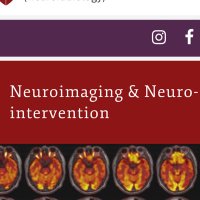 stanfordneuroimaging(@stanfordneuroi1) 's Twitter Profile Photo