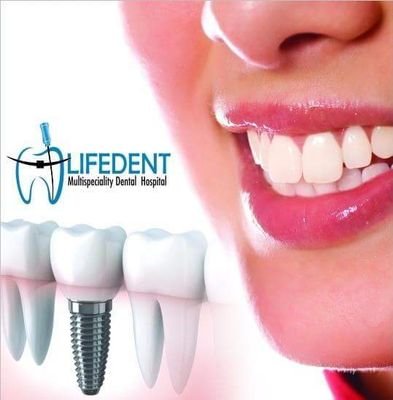 A highly sophisticated dental hospital with high tech instruments for implant and all other dental procedures.