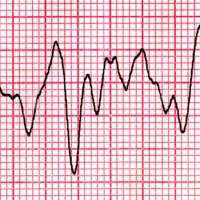 Causality Doctor (@causalitydoc) 's Twitter Profile Photo Causality Doctor (@causalitydoc) 's Twitter Profile Photo