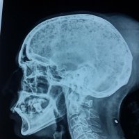 Dr Vineet Govinda Gupta (@drvineetgovinda) 's Twitter Profile