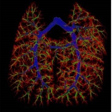 Experimental lung organogenesis and repair lab. 
Stem cell therapy research for chronic neonatal lung diseases.