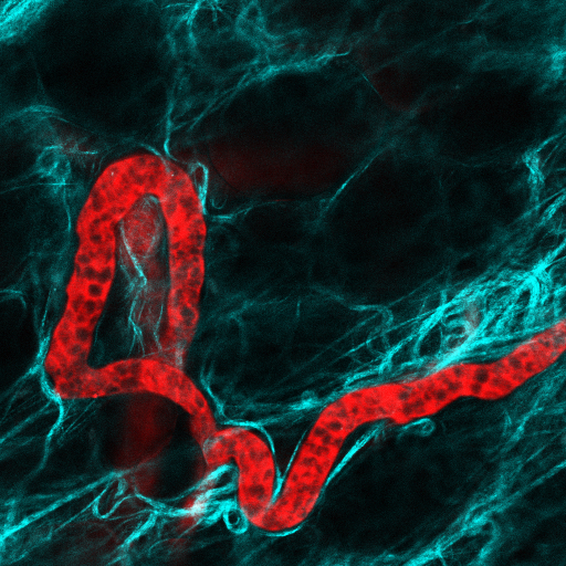 Our lab uses intravital imaging approaches to pinpoint critical events that drive tumour invasion and metastasis | @GarvanInstitute @KinghornCancer @UNSW