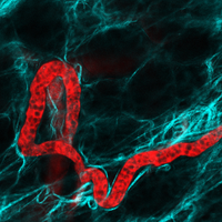 Invasion and Metastasis Lab (@timpson_lab) 's Twitter Profile