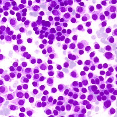 Cytopathology Review ®
Instagram: @mycytopathology
#Cytopathology #Cytopath #FNA #papsmear #MyCytopathology