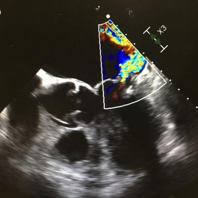 ValvulopatiasSEC Profile