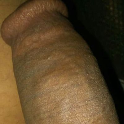 مرحبا