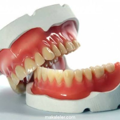 Çerezlik Diş Protez terimleri.
Diş Protez teknolojisi bölümü okuyan meslektaşlarım için oluşturduğum bir profildir.