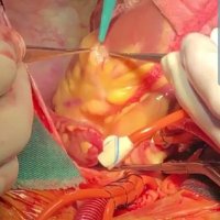 Radikalkvc Kosuyolu YİEAH (@radikalkvc) Twitter profile photo