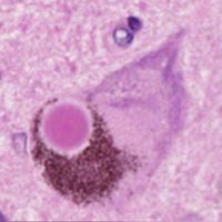 SpillantiniLab (@spillantinilab) 's Twitter Profile