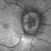 @EyeUHBTrust (@eyeuhbtrust) Twitter profile photo @EyeUHBTrust (@eyeuhbtrust) Twitter profile photo