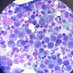 Hematología H. La Paz (@hematolapaz) Twitter profile photo Hematología H. La Paz (@hematolapaz) Twitter profile photo