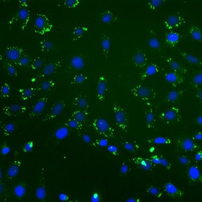 Tumour stroma and chemoresistance in pancreatic cancer, and the multifarious links between them, stand in the focus of our research.