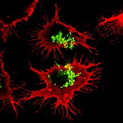 Bacterial Pathogenesis & Immunity group led by Aras Kadioglu. We work on host-pneumococcal interactions; carriage & transmission, co-infections, Tregs, vaccines