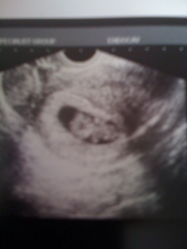 emmabillien's profile picture. 