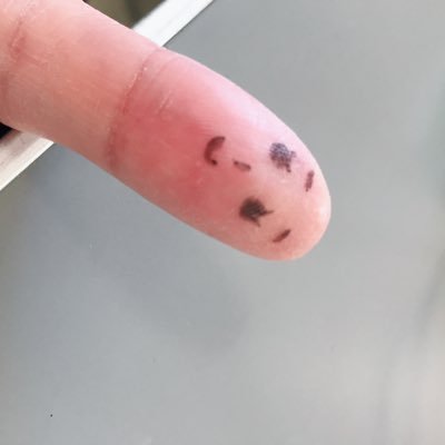 ハイジ 今日から始める プラセンタゼリーとビタミンサプリ どれくらいの効果があるのか とりあえず唇の荒れを救済してください サプリ マルチビタミン プラセンタゼリー