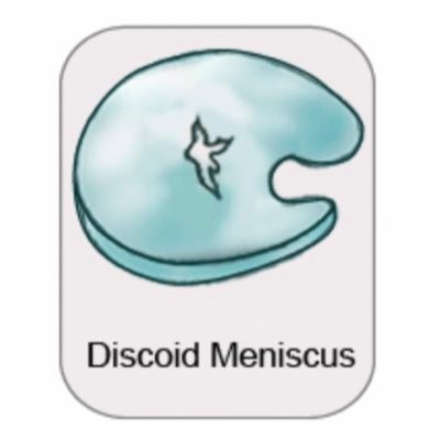 DiscoidMeniscus Profile