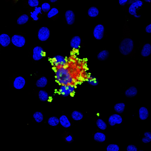 Cell Death and Immunity Laboratory. We are interested in the mechanisms of #Apoptosis, #Necroptosis and #Inflammation in #Cancer. Posts by @ttenev