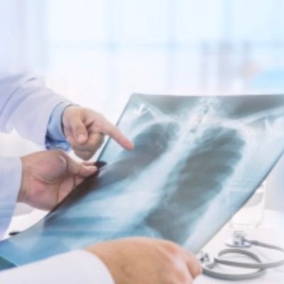 Diagnosed with Mesothelioma or Lung Cancer? Call The Steinberg Law Group at 1 888 891-2200