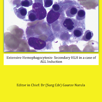 Pediatric Hematology Oncology Journal
