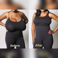 Breast Reduction Support SA (@brsupportsa) 's Twitter Profile