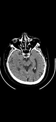 LabUfrj's profile picture. Research in Stroke Rehabilitation