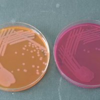 Microbiology & Infection at Cardiff Met Uni (@mirg_cmu) 's Twitter Profile Photo Microbiology & Infection at Cardiff Met Uni (@mirg_cmu) 's Twitter Profile Photo