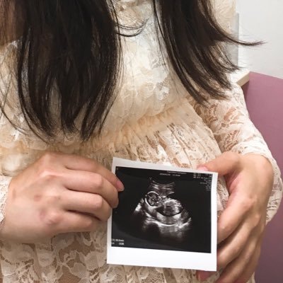 管理栄養士 4m A Twitter いろんな種類のスタイ 生まれたてはなかなか使うことないよと後になって聞いた スタイ 手作りスタイ 手作り ハンドメイド 手縫い 妊娠後期 プレママ 初マタさんと繋がりたい 初マタ