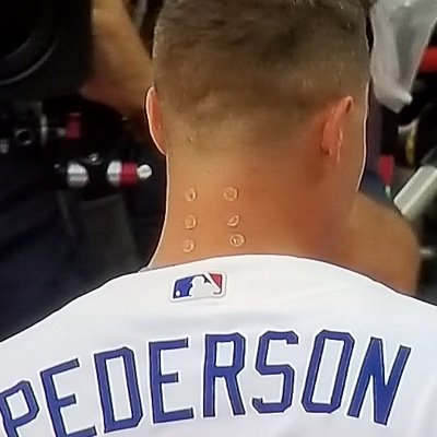 Twitter Went Nuts Trying To Figure Out What Was On Joc Pederson S Neck At Hr Derby