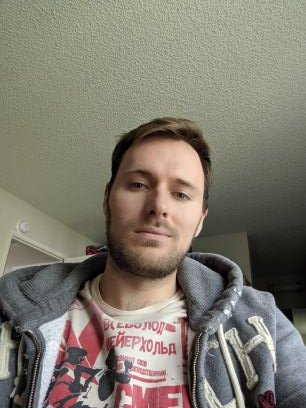 A. πΊπ¦ Profile