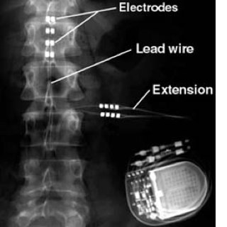 NerveInjurySupp's profile picture. Just a simple Bionic Chick.. recently raspberry rippled..