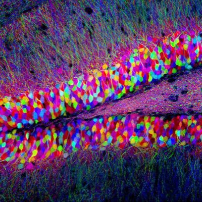 Neuroscience Researcher, Writer and Nerd. Research Interests: Neurodegeneration, Protein Misfolding and Toxicology #sharetheorange