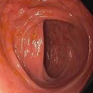 SoMe4endoscopy (@some4endoscopy) 's Twitter Profile