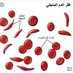 الأنيميا المنجلية @ (@sikclecell) Twitter profile photo الأنيميا المنجلية @ (@sikclecell) Twitter profile photo
