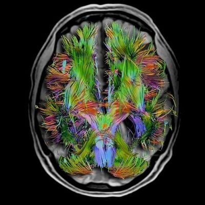 AddictionTrauma's profile picture. #trauma #EMDR #addiction