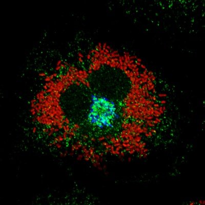celli_lab's profile picture. Cell biological approaches to study intracellular bacteria, with a particular love for Brucella. Views are our own.