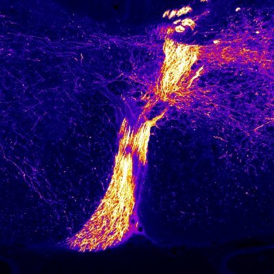 Hello. I'm a bot. I auto-tweet Spinal Cord Injury research deposited on the bioRxiv preprint server. I'm  @SCI_PubBot's hipster sibling.