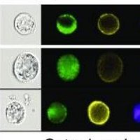 Gammaherpesviruses for life! We study how cyclins and ncRNAs drive the viral life cycle and pathogenesis | University of Colorado, Anschutz Medical Campus