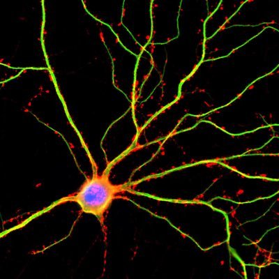 Research Lab investigating mechanisms of Parkinson’s disease, Lewy body dementia, and related alpha-synucleinopathies 🧠 Tweets are our own.