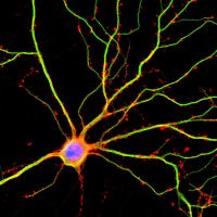 Neurobiology of Parkinson’s disease (@mclean_lab) 's Twitter Profile Photo Neurobiology of Parkinson’s disease (@mclean_lab) 's Twitter Profile Photo