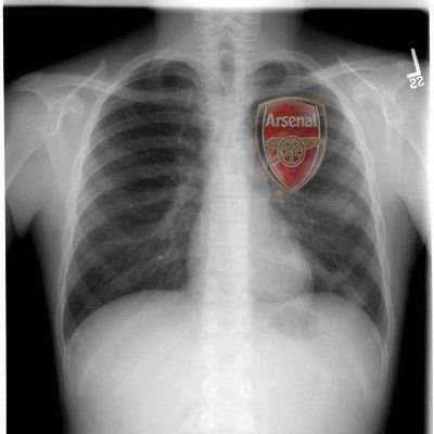 justnnamdi's profile picture. Cardiac/Transplant Surgeon @WythenshaweHosp @NorthMcrGH_NHS @MFTnhs, graduate @QUBelfast @QMUL @DukeCTSurgery, Lifelong Learner on #cardiotwitter 🙏