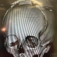 SheffNeuroSurg (@sheffneurosurg) 's Twitter Profile Photo SheffNeuroSurg (@sheffneurosurg) 's Twitter Profile Photo