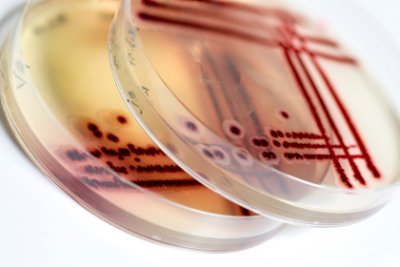 News from the Department of Microbiology & Biotechnology at  the Universität Hamburg