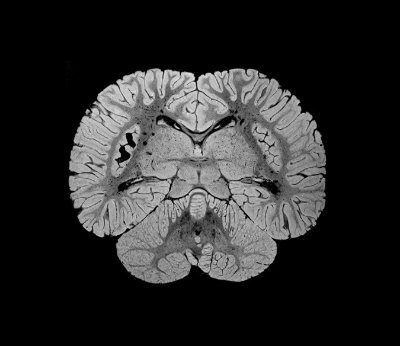 Physician. Neuroradiologist. Brain, spine, head, and neck. Listens to faint whimpers of nuclear spins, slowly dephasing against the static field.