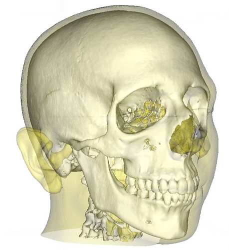 idoimaging's profile picture. I Do Imaging: Free and open source medical imaging software.