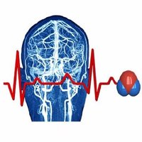 TAME Cardiac Arrest (@tametrial) 's Twitter Profile