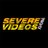 SevereVideos