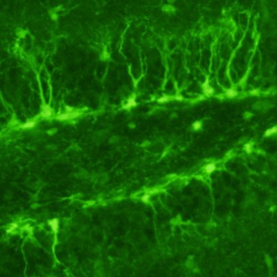 The Eisch Lab asks