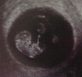 UnbornBabyBlack's profile picture. Im the unborn baby of @Just_BellaSwan_ and @RussetWolfe .. +18 RP